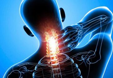 intense neck pain in advanced osteochondrosis