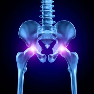 Hip joint pain can be acute, aching or chronic
