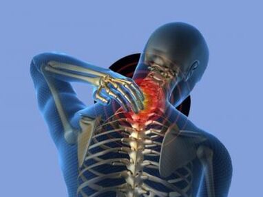 A person suffering from osteochondrosis of the cervical spine is bothered by neck pain