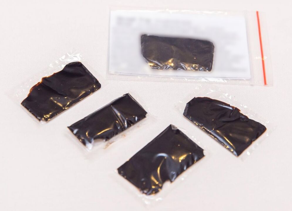 Shilajit is an effective drug for home treatment of cervical osteochondrosis